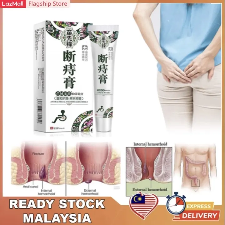 Sokany Malay Spot Hemorrhoid Ointment Treatment Herbal Cream Natural Chinese Medicine Suppository Powerful Hemorrhoids Creamhemorrhoid Ointment Herbal Cream Natural Chinese Medicine Suppository Powerful Hemorrhoids Cream Relieve Hemorrhoids Pain 痔疮