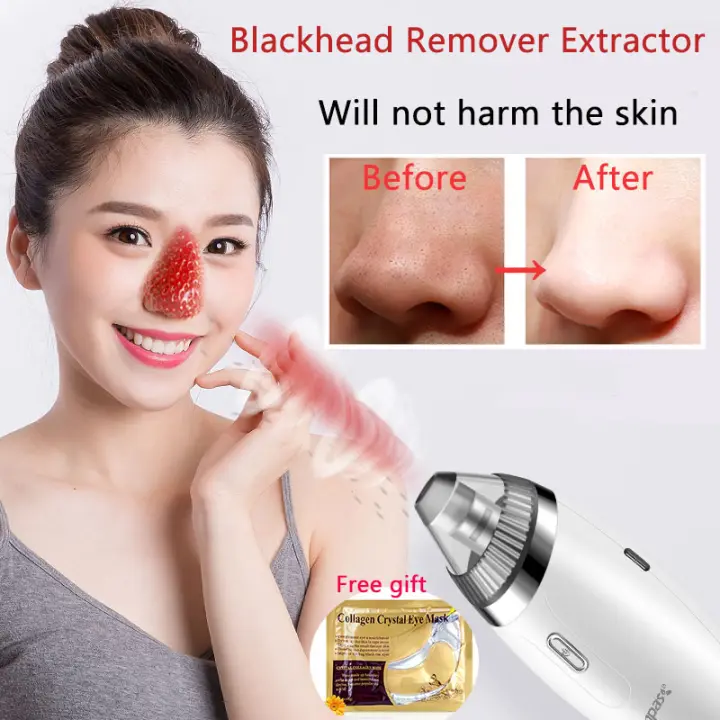 Ready Stock Malaysia）Facial Cleaning 5 Tips Blackhead Remover Electric  Vacuum Suction Blackhead Acne Extractor Pores Deeply Cleaning Tool  Whitehead Extractor Multifunctional Skin Care Beauty Device Face Blackhead  Cleaner | Lazada