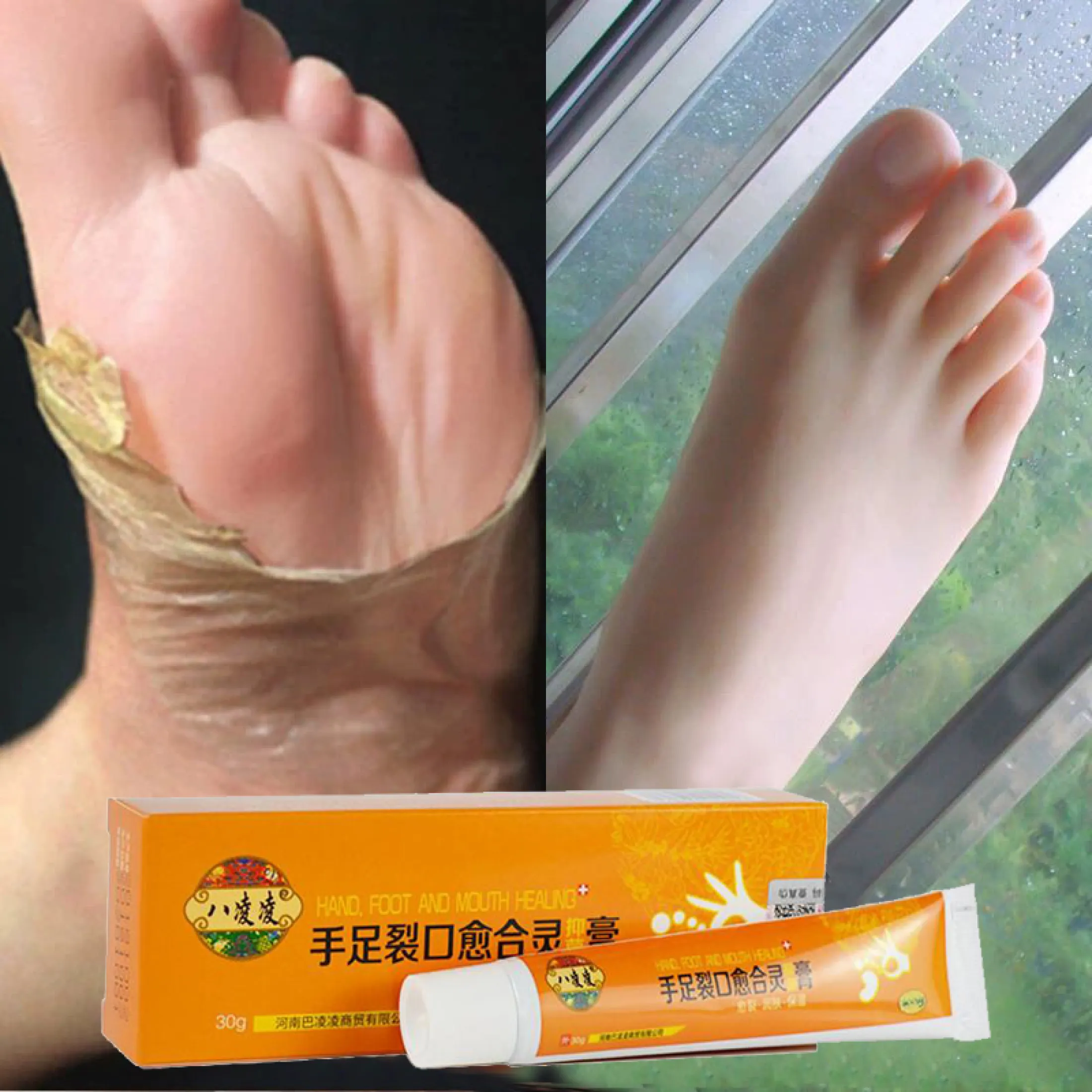 100 Asli Obat Cina Tangan Kaki Retak Cream Tumit Pecah Pecah Peeling Kaki Dan Tangan Perbaikan Anti Dry Retak Perawatan Kulit Lazada Indonesia