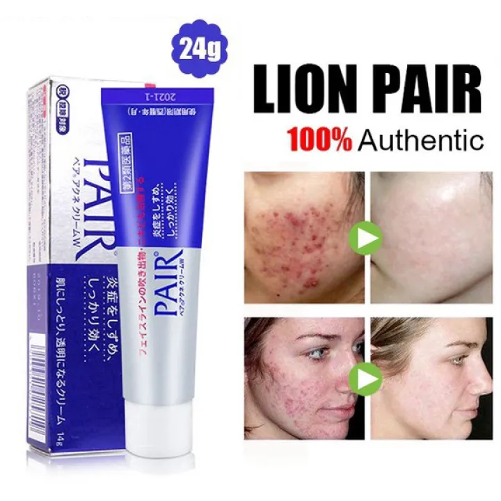 Lion Pair Japan Acne Cream Scar Removal Face Cream Skin Care 24g Lazada Singapore