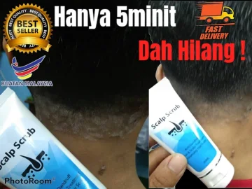 Beli Shampoo Kulit Kepala Berkuping Pada Harga Terendah Lazada Com My