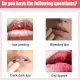 Eelhoe Lip Lightening Cream Moisturizing Brighten Remove Black Lips Reduce Pigmentation Lip Care Ointment Prevent Dryness Crack Peeling Fade Lip Lines Lip Balm Deep Nourishment Remove Dark Smoke Lip Care Cream（30g）. 