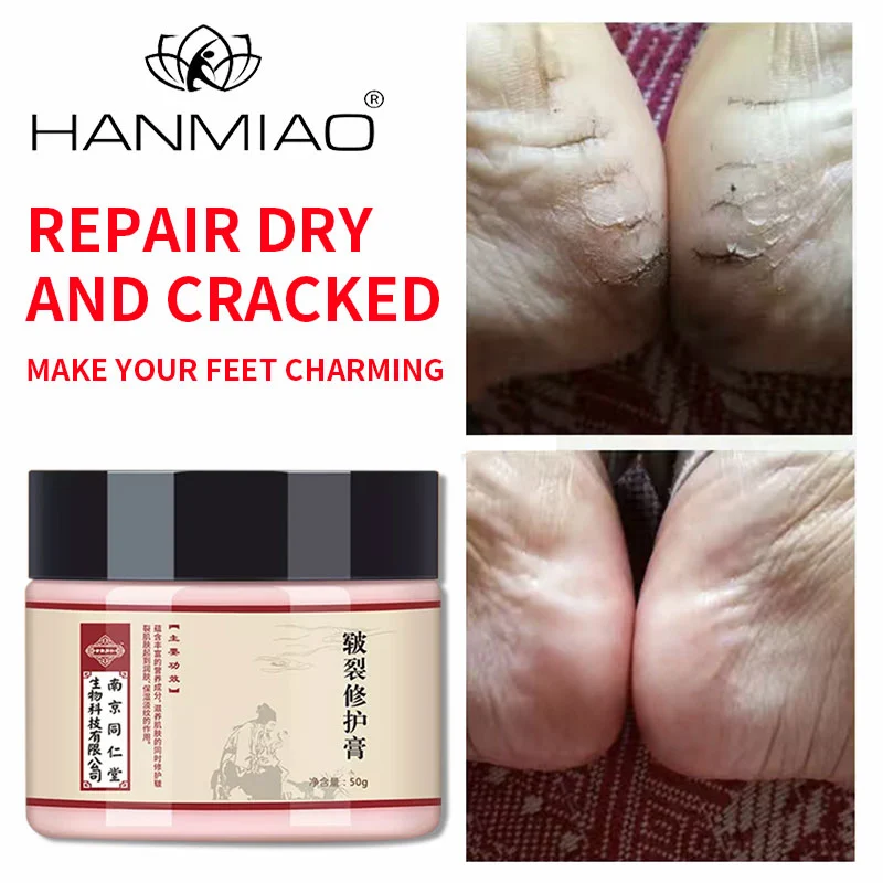 Aging skin repair cream repair cracked skin moisturizing repair function moisturizing cream skin repair