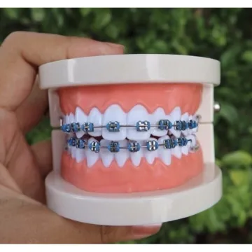 Beli Braces Gigi Click Murah Pada Harga Terendah Lazada Com My