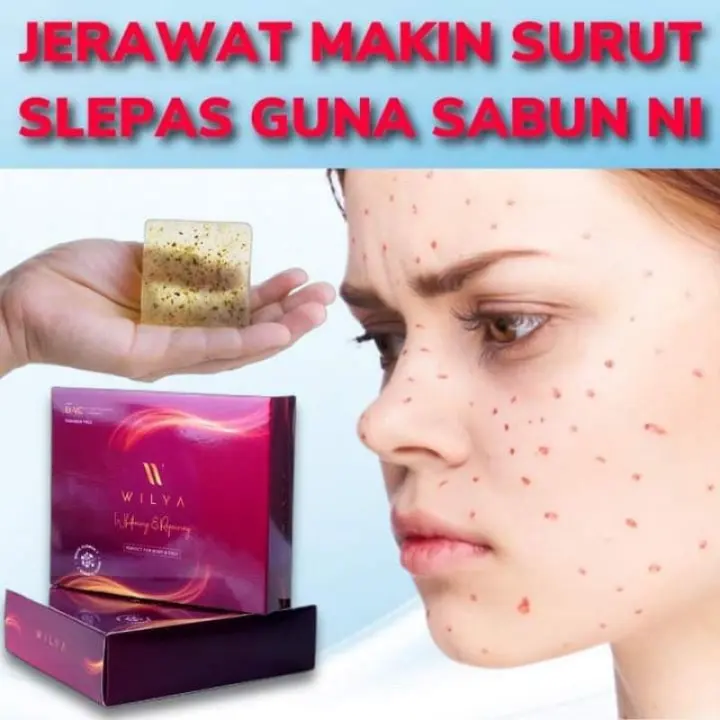 Jual Parsel Ramadhan Paket Cerah Bebas Daki Sr12 Ampuh Hilangkan Daki Paket 2 Kota Bandung Aulian Herbalskincaresr12 Bandung Tokopedia